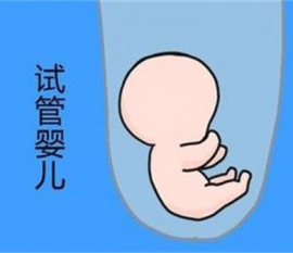 美国生子费用是多少？哪些地方需要花钱？