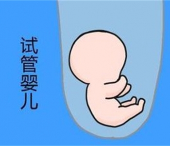 美国生子费用是多少？哪些地方需要花钱？